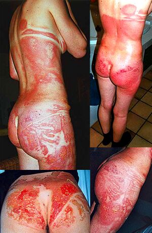 Cn asariniu duju poveikis efektai.jpg