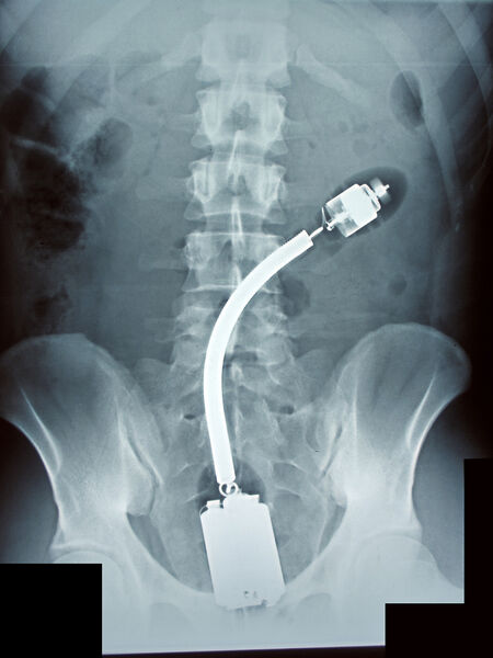 Vaizdas:Istriges vibratorius.jpg